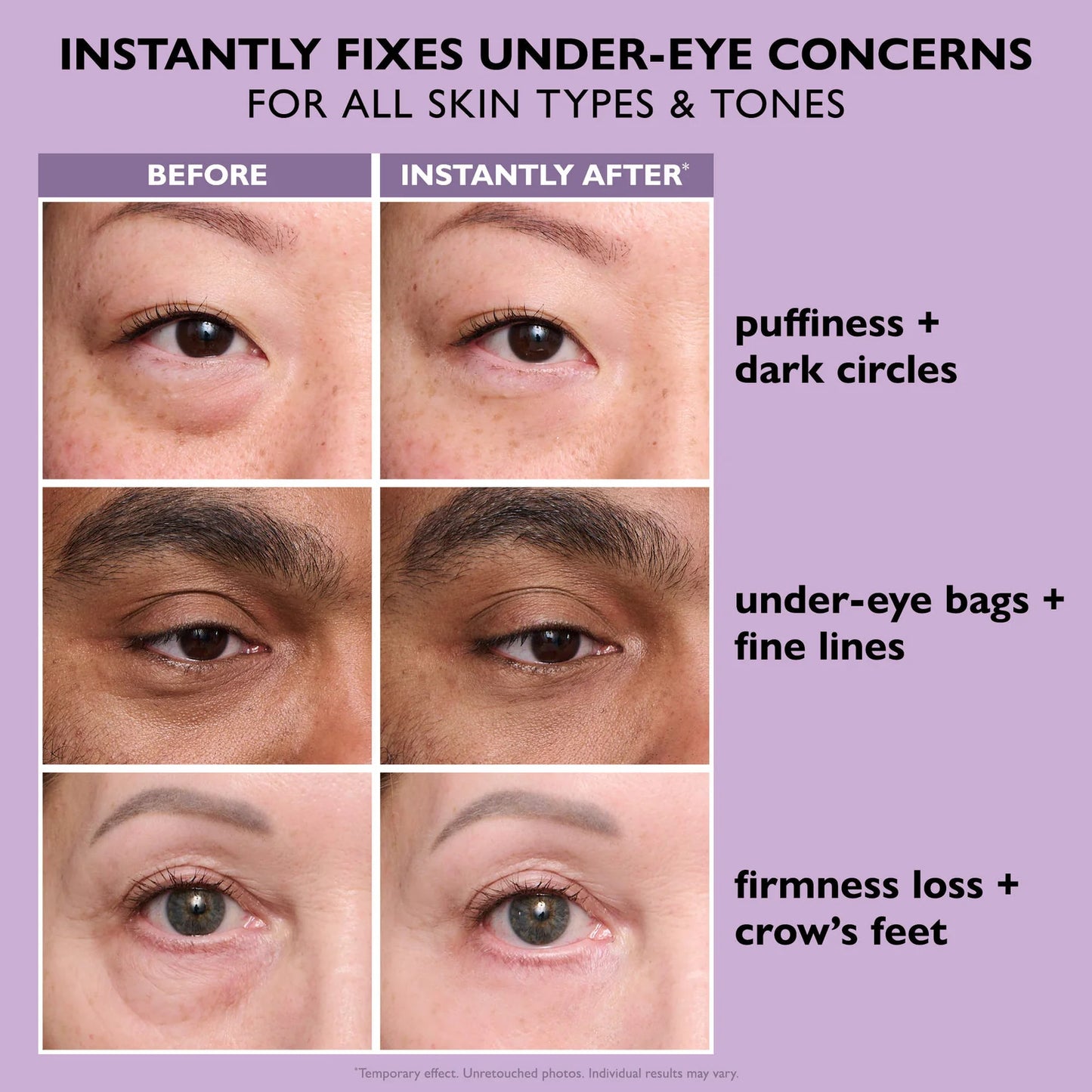 Instant FirmX Eye Tightener - Helps Smooth Fine Lines & Reduce Puffiness Dark Circles